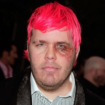 Perez-hilton-black-eye.jpeg